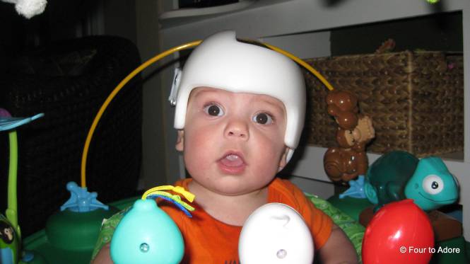 Mason carried on playing as usual even with his DOC Band.  However, the white looked frumpy and clinical to me.